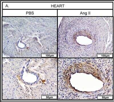 Immunohistochemistry-Paraffin: Thrombospondin-1 Antibody (A6.1) [NB100-2059]