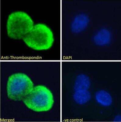 Immunocytochemistry/ Immunofluorescence: Thrombospondin-1 Antibody [NBP1-52410]