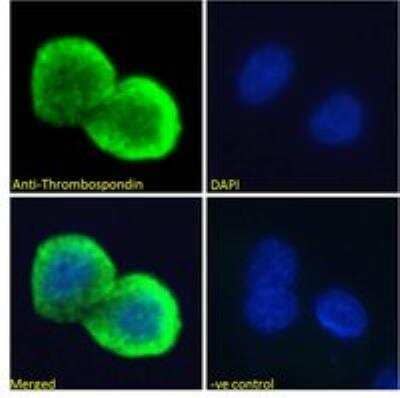 Immunocytochemistry/ Immunofluorescence: Thrombospondin-1 Antibody [NBP2-42522]