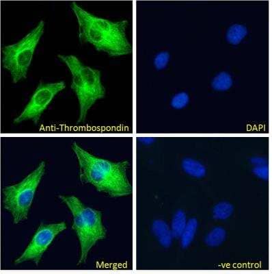 Immunocytochemistry/ Immunofluorescence: Thrombospondin-1 Antibody [NBP2-42522]