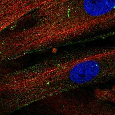 Immunocytochemistry/ Immunofluorescence: Thrombospondin-1 Antibody [NBP2-56694]