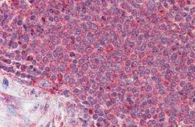 Immunohistochemistry-Paraffin: Thrombospondin-1 Antibody [NBP1-52410]