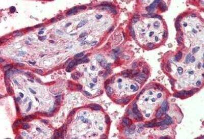 Immunohistochemistry-Paraffin: Thrombospondin-1 Antibody [NBP1-52410]