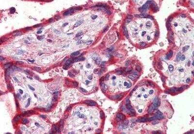 Immunohistochemistry-Paraffin: Thrombospondin-1 Antibody [NBP2-42522]