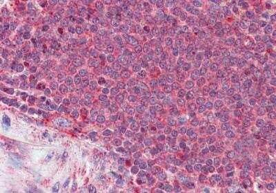Immunohistochemistry-Paraffin: Thrombospondin-1 Antibody [NBP2-42522]