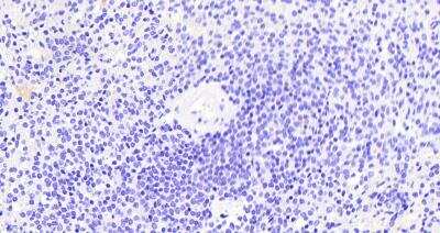 Immunohistochemistry-Paraffin: Thrombospondin-1 Antibody [NBP2-42522]