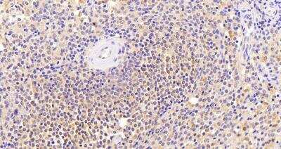 Immunohistochemistry-Paraffin: Thrombospondin-1 Antibody [NBP2-42522]