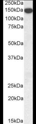 Western Blot: Thrombospondin-1 Antibody [NBP1-52410]