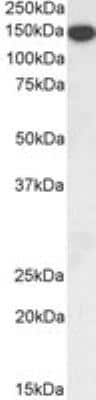 Western Blot: Thrombospondin-1 Antibody [NBP2-42522]