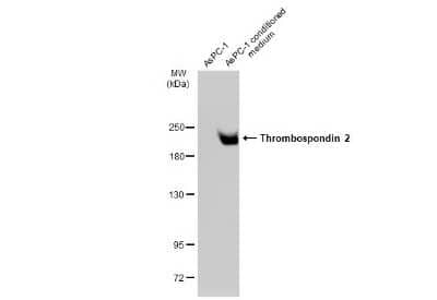 Western Blot: Thrombospondin-2 Antibody (GT147) [NBP3-13654]