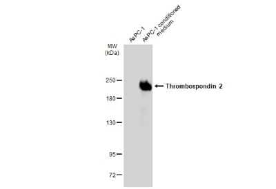 Western Blot: Thrombospondin-2 Antibody (GT7511) [NBP3-13653]