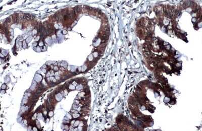 Immunohistochemistry-Paraffin: Thrombospondin-2 Antibody [NBP3-13398]
