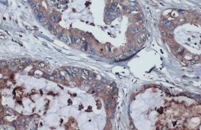 Immunohistochemistry-Paraffin: Thrombospondin-2 Antibody [NBP3-13398]