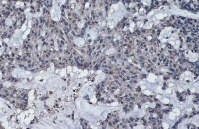 Immunohistochemistry-Paraffin: Thrombospondin-2 Antibody [NBP3-13399]