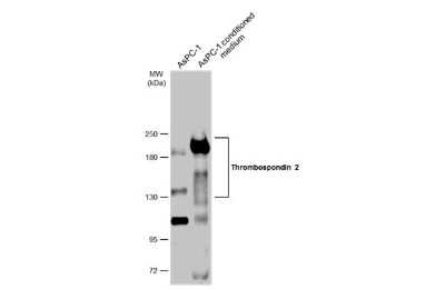 Western Blot: Thrombospondin-2 Antibody [NBP3-13398]