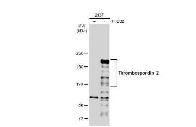 Western Blot: Thrombospondin-2 Antibody [NBP3-13398]