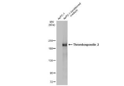 Western Blot: Thrombospondin-2 Antibody [NBP3-13399]