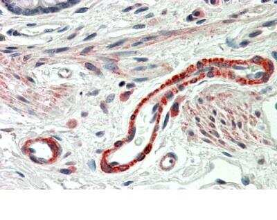 Immunohistochemistry-Paraffin: Thrombospondin-3 Antibody [NBP1-36996]