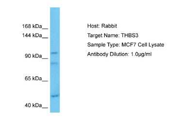 Western Blot: Thrombospondin-3 Antibody [NBP2-85911]