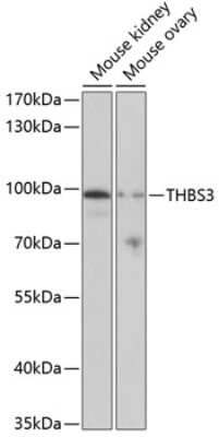 Western Blot: Thrombospondin-3 AntibodyBSA Free [NBP2-94865]