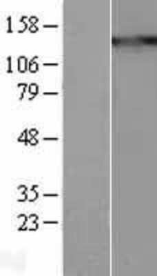 Western Blot: Thrombospondin-1 Overexpression Lysate [NBL1-16878]