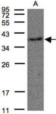 Western Blot: Thromboxane A2 R/TBXA2R Antibody [NBP1-31106]