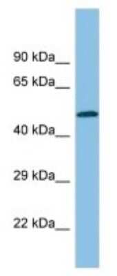 Western Blot: Thromboxane A2 R/TBXA2R Antibody [NBP3-10561]