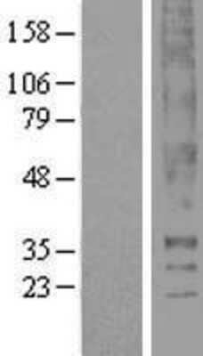 Western Blot: Thromboxane A2 R/TBXA2R Overexpression Lysate [NBL1-16752]