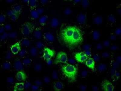 Immunocytochemistry/ Immunofluorescence: Thromboxane synthase Antibody (OTI2C1) [NBP2-02710]