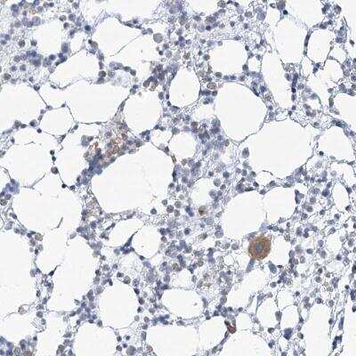 Immunohistochemistry: Thromboxane synthase Antibody [NBP2-33947]