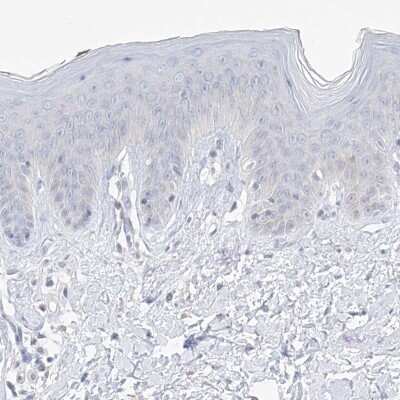 Immunohistochemistry-Paraffin: Thromboxane synthase Antibody [NBP2-33947]