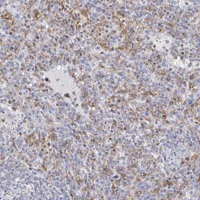 Immunohistochemistry-Paraffin: Thromboxane synthase Antibody [NBP2-33947]