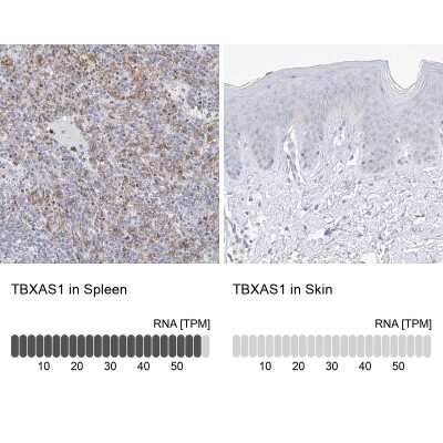 Immunohistochemistry-Paraffin: Thromboxane synthase Antibody [NBP2-33947]