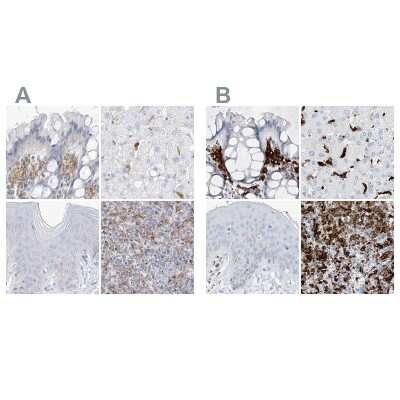Immunohistochemistry-Paraffin: Thromboxane synthase Antibody [NBP2-33947]