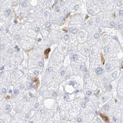 Immunohistochemistry-Paraffin: Thromboxane synthase Antibody [NBP2-33947]