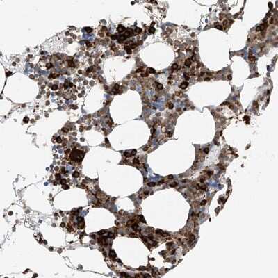 Immunohistochemistry-Paraffin: Thromboxane synthase Antibody [NBP2-33948]