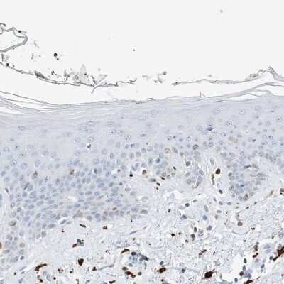 Immunohistochemistry-Paraffin: Thromboxane synthase Antibody [NBP2-33948]