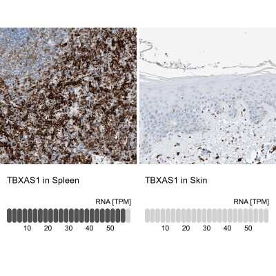 Immunohistochemistry-Paraffin: Thromboxane synthase Antibody [NBP2-33948]