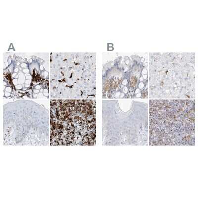 Immunohistochemistry-Paraffin: Thromboxane synthase Antibody [NBP2-33948]