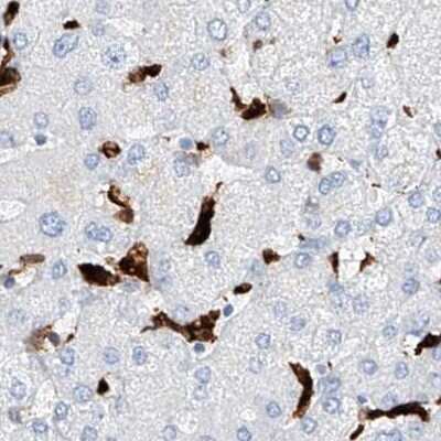 Immunohistochemistry-Paraffin: Thromboxane synthase Antibody [NBP2-33948]