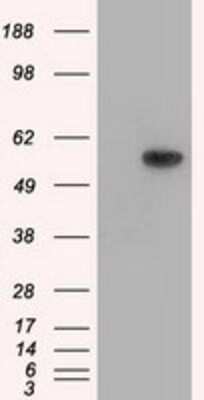 Western Blot: Thromboxane synthase Antibody (OTI2C1)Azide and BSA Free [NBP2-74505]