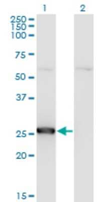 Western Blot: Thymidine Kinase 1 Antibody (1D10) [H00007083-M04]