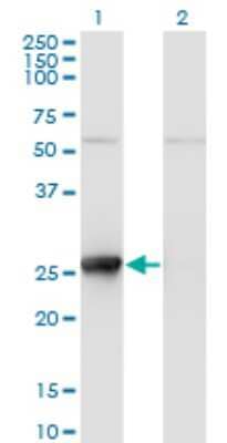 Western Blot: Thymidine Kinase 1 Antibody (2A2) [H00007083-M11]