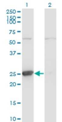 Western Blot: Thymidine Kinase 1 Antibody (3E2) [H00007083-M06]