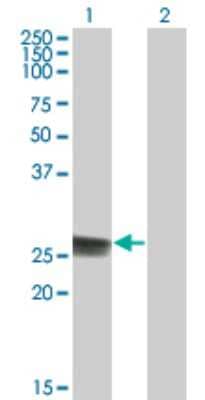 Western Blot: Thymidine Kinase 1 Antibody (3F9) [H00007083-M05]