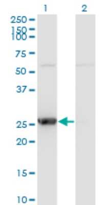 Western Blot: Thymidine Kinase 1 Antibody (3G10) [H00007083-M07]