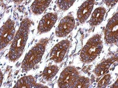Immunohistochemistry-Paraffin: Thymidine Kinase 1 Antibody [NBP2-20626]