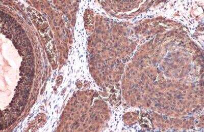 Immunohistochemistry-Paraffin: Thymidine Kinase 1 Antibody [NBP2-20626]