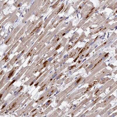Immunohistochemistry-Paraffin: Thymidine Kinase 2 Antibody [NBP1-92505]