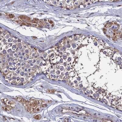 Immunohistochemistry-Paraffin: Thymidine Kinase 2 Antibody [NBP1-92505]